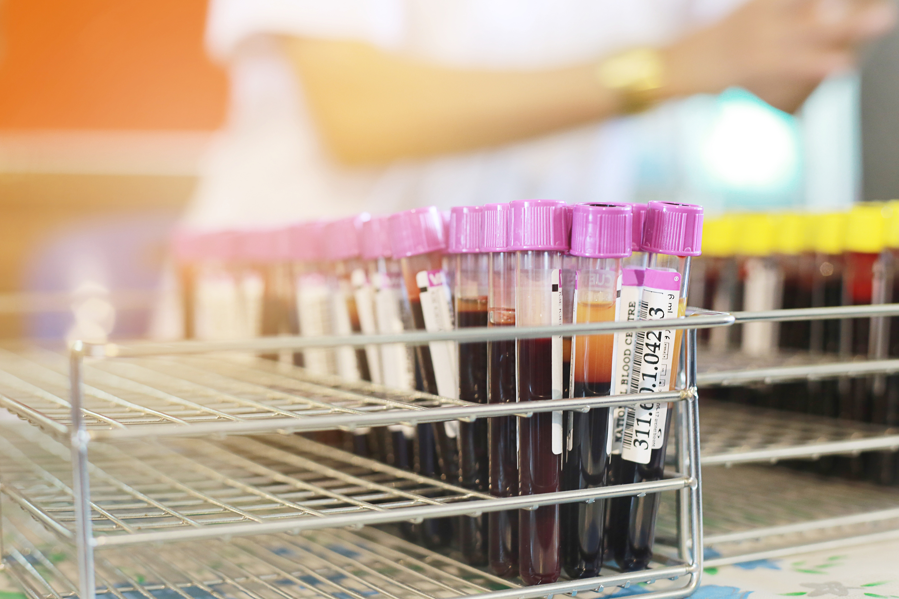 Blood sample tubes from blood donation for analysis